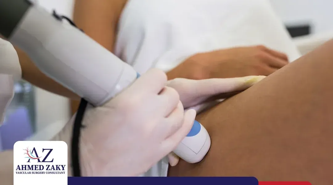 هل يمكن علاج دوالي الساقين نهائيًا دون جراحة؟
